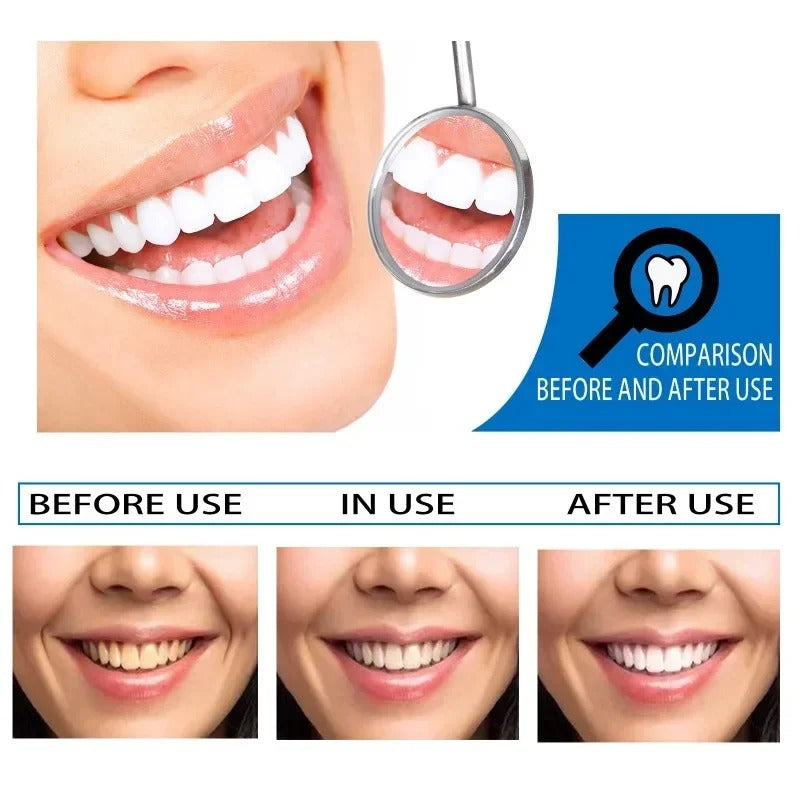 Teeth Whitening Serum